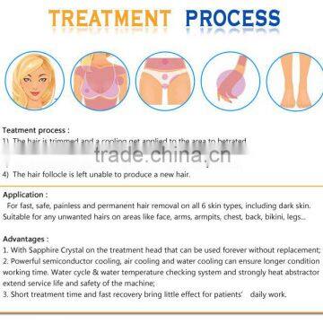 Promotion 808nm d Diode Laser Equipment for All Kinds of Hair Removal photo-4