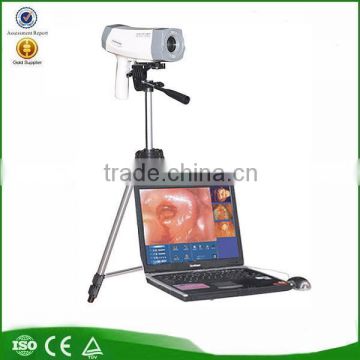 Electronic Colposcope RCS-400 digital vaginal mirror SONY 800,000 pixels