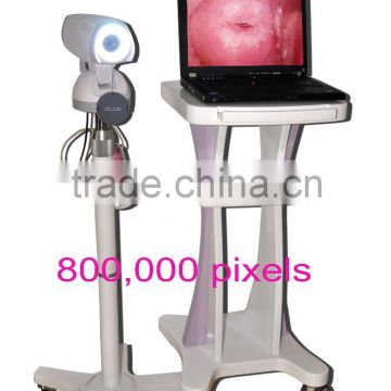 Digital High-Pixel Electronic Colposcope(RCS-500)