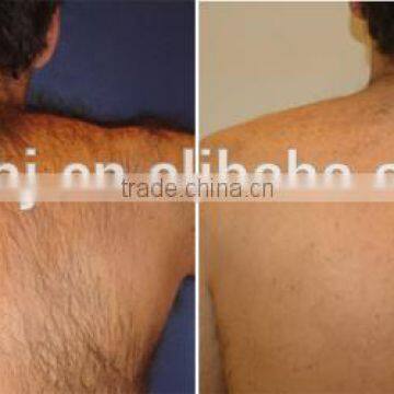 800mj 1064nm Long Pulse Nd Yag Laser For Varicose Veins Blood Vessel Spider Vein Treatment Permanent Tattoo Removal photo-5