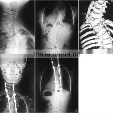 film of mammography,mammography film