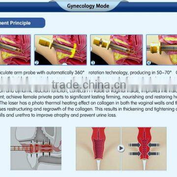 Most Advanced High Quality Beauty Equipment 10600 nm Laser Co2 Surgical Laser With USA Tube photo-6