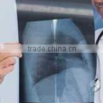 xray film portable x ray equipment used 14*17inch China Factory