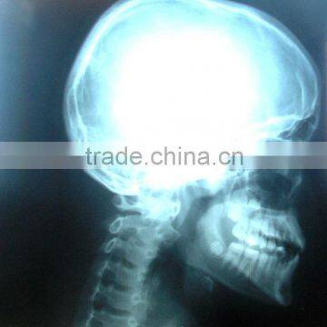 China KND-A/F CE imagens de raio x