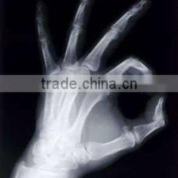 125 micron A4 Sheet PET Laser Printing Medical X ray Film