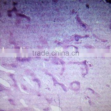 Fibrous Hyperplasia of Bone Sec. Oral Histology Pathology Parasitology Prepared Slides photo-2