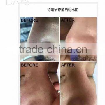 Beauty Salon Machine Water Oxygen Jet photo-5