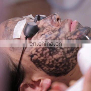 Most-welcomed IPL RF E-light Alexandrite Nd Yag Laser for Tattoo and Hair Removal Laser Machine/tattoo Laser Removal Machine