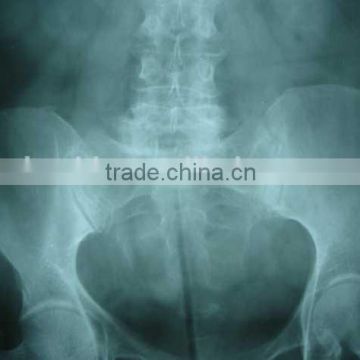 fuji x-ray film, agfa x-ray film 14x17 for chinese medical equipments