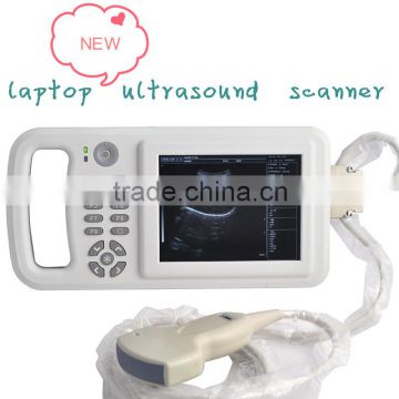 6.5 inch LCD with clear image Handheld Ultrasoud Scanner RUS-8000A