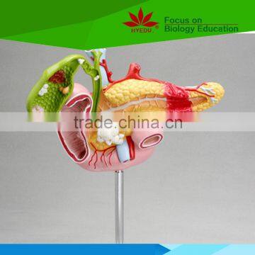High quality Medical teaching human pancreas model