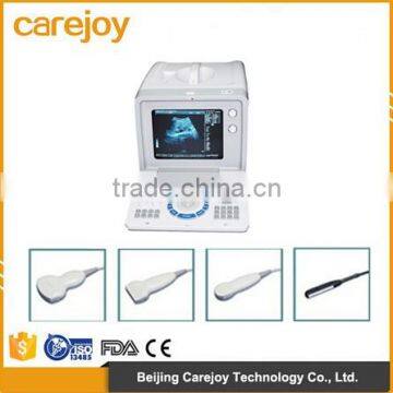 Cheap Portable Ultrasound Machine Ultrasonic Diagnostic Scanner with Convex linear transvaginal rectal Probe optional