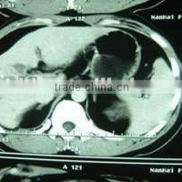 x-ray digital film, x-ray medical film,x-ray thermal film