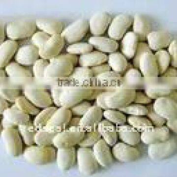 45-65 Yunnan large white kidney bean