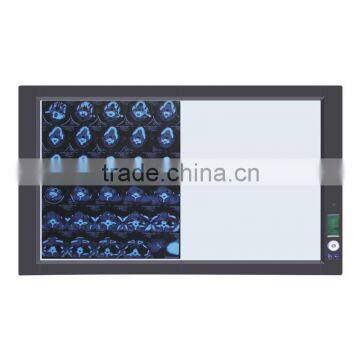 Led x Ray Medical View Box photo-2