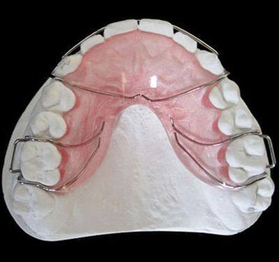 Zirconia Bridge China Dental Lab china dental lab outsourcing