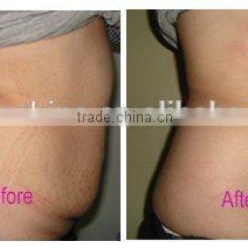 HOTTEST Kim 8 New Ultrasonic Liposuction Equipment Cavitation Rf Vacuum Slimming Machine Weight Loss Equipment Slimming Machine photo-3