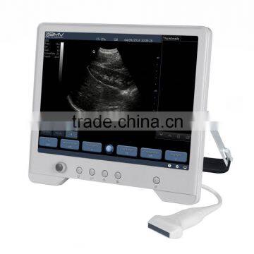 B Mode Portable Ultrasound Price TS20