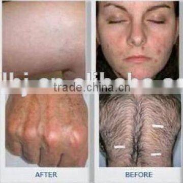 Gold Standard Laser IPL & E-light Hair Removal Equipment&machine for Spa Use photo-2