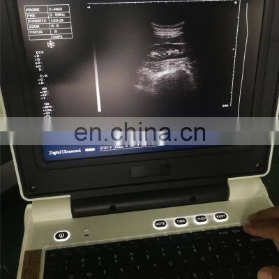 Medical Equipment Laptop Black and White Medical Latest Ultrasound Machine Color Doppler Ultrasound for Hospital