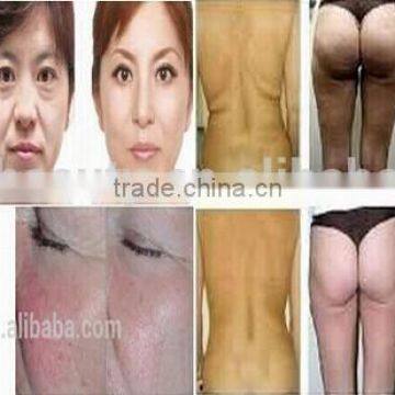 China Best Sale Cavitation Ultrasonic Beauty Machine/ Cavitation Machine With Two rf Heads, One Vacuum Head & Cavitation