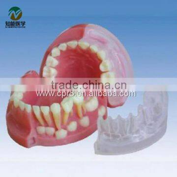 BIX-L1021 Three years old children milk teeth and permanent teeth alternate model