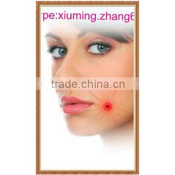 China original manufacturer of Mouth Ulcer Patch