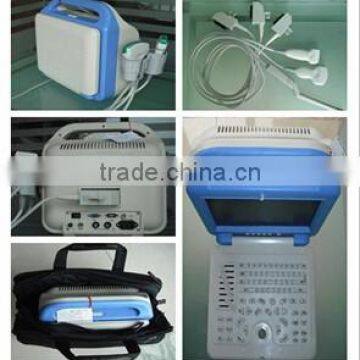 2016 LCD Display Ultrasound Scanner With Convex Probe photo-3