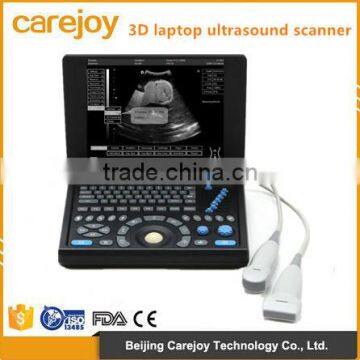 2016 new 3D laptop ultrasound scanner (PC system) on Sale