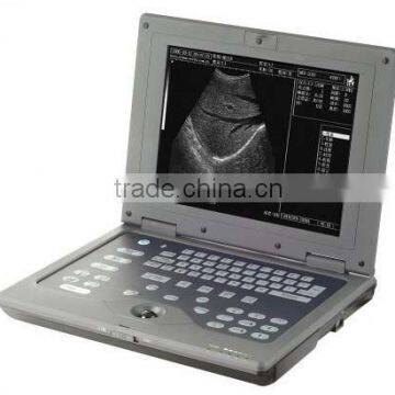 Ultrasound Scanner