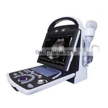 MY-A003B medical products laptop ultrasound b scan diagnostic ultrasound machine with probes