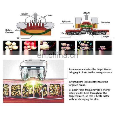 Best Seller 6 In 1 Vacuum Cavitation Machine Vacuum Cavitation System Cavitation RF Vacuum Slimming Machine photo-5