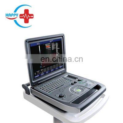 HC-A012D Laptop color doppler ultrasound fetal doppler ultrasound baby heartbeat