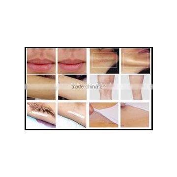 Skin Cooling Machine for Laser Hair Removal Machine photo-6