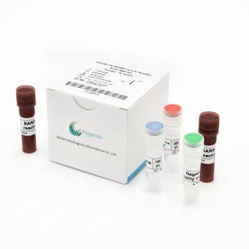 COVID-19 (SARS-CoV-2) Nucleic Acid Test Kit