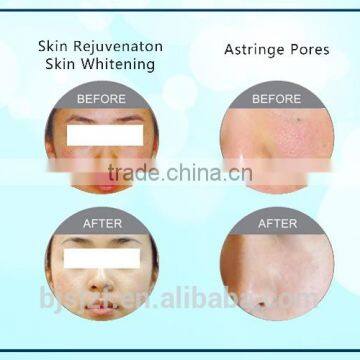 Vertical Laser Pore Repairing Machine F6 With CE Approval