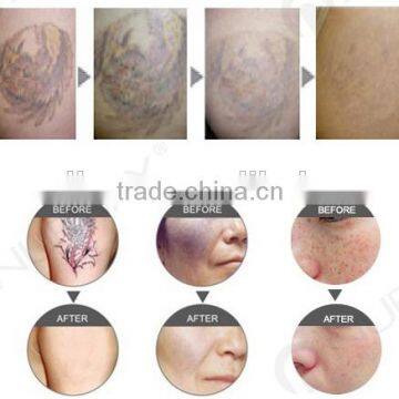 Best Q-switched nd Yag Laser Tattoo Pigment Removal Equipment /q-switched Laser Skin Rejuvenation Machine