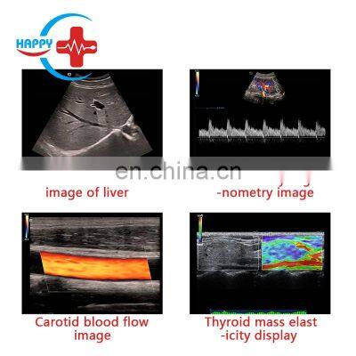 Best-selling Trolley Mindray Dc-40 Color Doppler Ultrasound Machine Portable Mindray Ultrasound Device