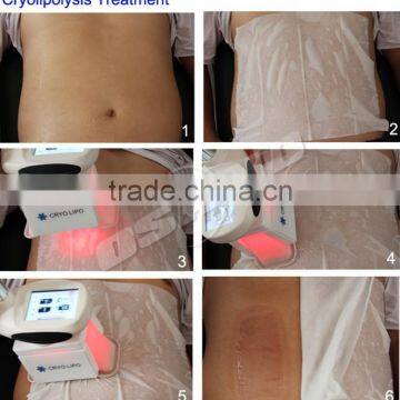 Mini Cryolipolysis For Home Use photo-5