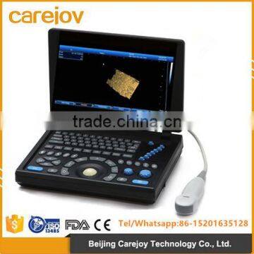 2016 new 3D laptop ultrasound machine low price