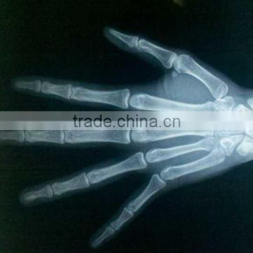 medical thermal x ray film,Pet Clinic,agfa film dt2b,agfa x-ray film