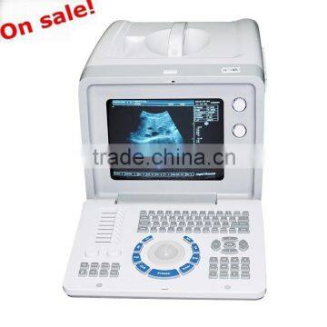 On sale B scan image Portable Ultrasound Scanner machine Ultrasonic Diagnostic System RUS-6000D with 3.5MHz Convex Probe