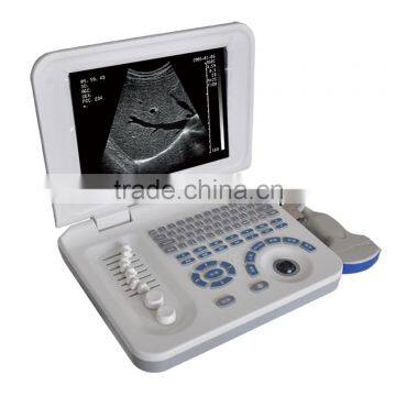 Hospital Full-digital Cheap Battery Diagnosis Equipment Laptop Ultrasound 3018