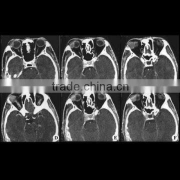 Kodak medical xray film with good quanlity manufacturer