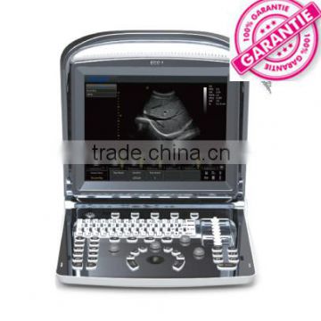 High end Ultrasound Scanner ECO1 optional Convex linear rectal transvaginal probe foot switch video printer