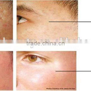 2016 Express Micro Needle rf / Fractional rf Microneedle Sale /radio Frequency Wrinkle Removal and Skin Rejuvenation photo-6