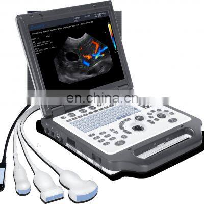 Best Quality 2d Color Portable Veterinary Ultrasound For Animal