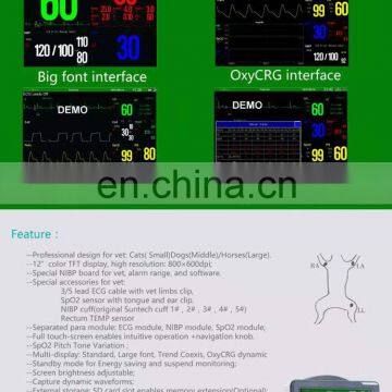 MY-W003C Medical Monitoring Portable 12 Inch Veterinary Vital Signals Multiparameter Patient Monitor Price photo-3