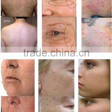 Skin Care Multifunctional 3 Handles Maquina Ipl Depilacion Laser Ipl Beauty Salon Equipment Ipl Hair Removal Machine With Factory Price Skin Tightening photo-3