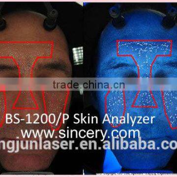 Body Slimming Equipment Tracking Treatment Machine 3D Skin Analyzer photo-3